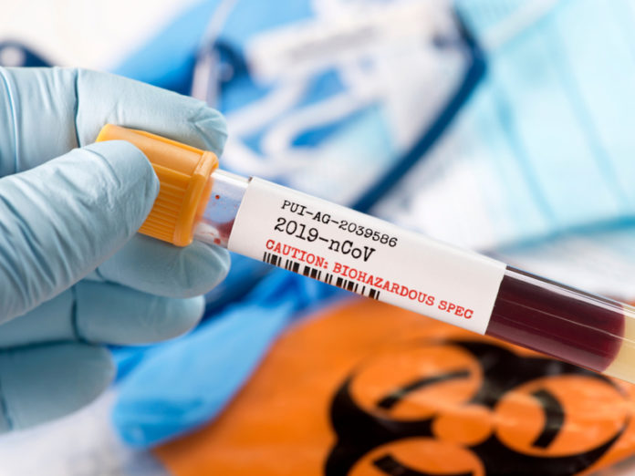 Coronavirus