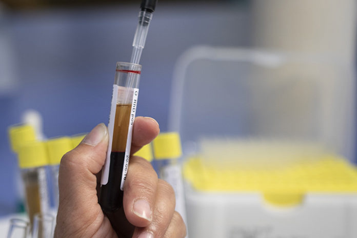 Coronavirus