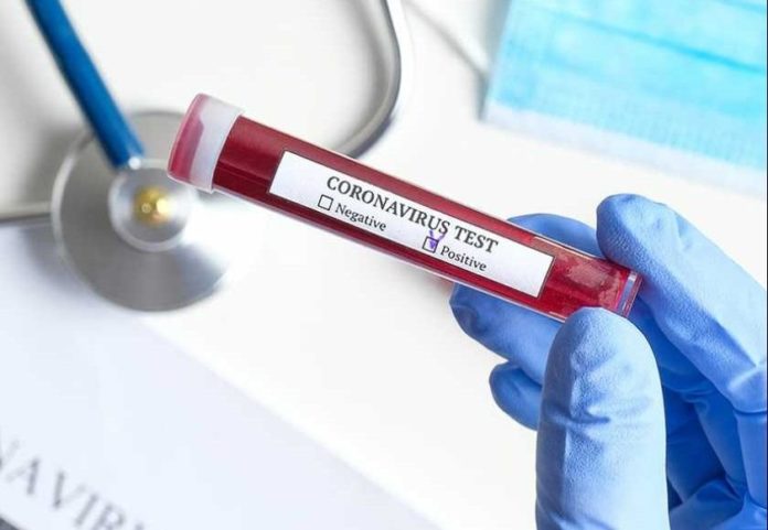 Coronavirus