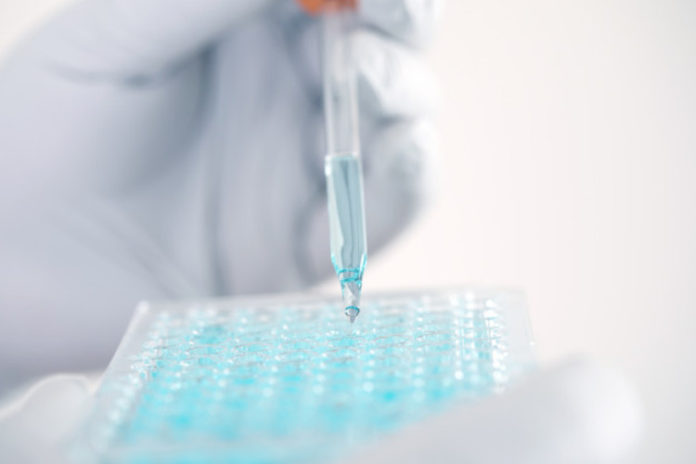 Equipos de Diagnóstico Molecular Equipos de Diagnóstico Molecular