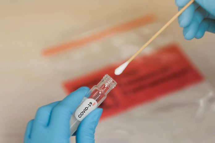 4T restringe importación de pruebas de coronavirus 4T restringe importación de pruebas de coronavirus