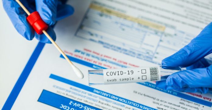 Cofepris avala pruebas serológicas Cofepris avala pruebas serológicas
