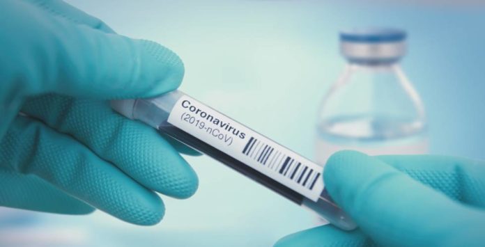 Laboratorio covid